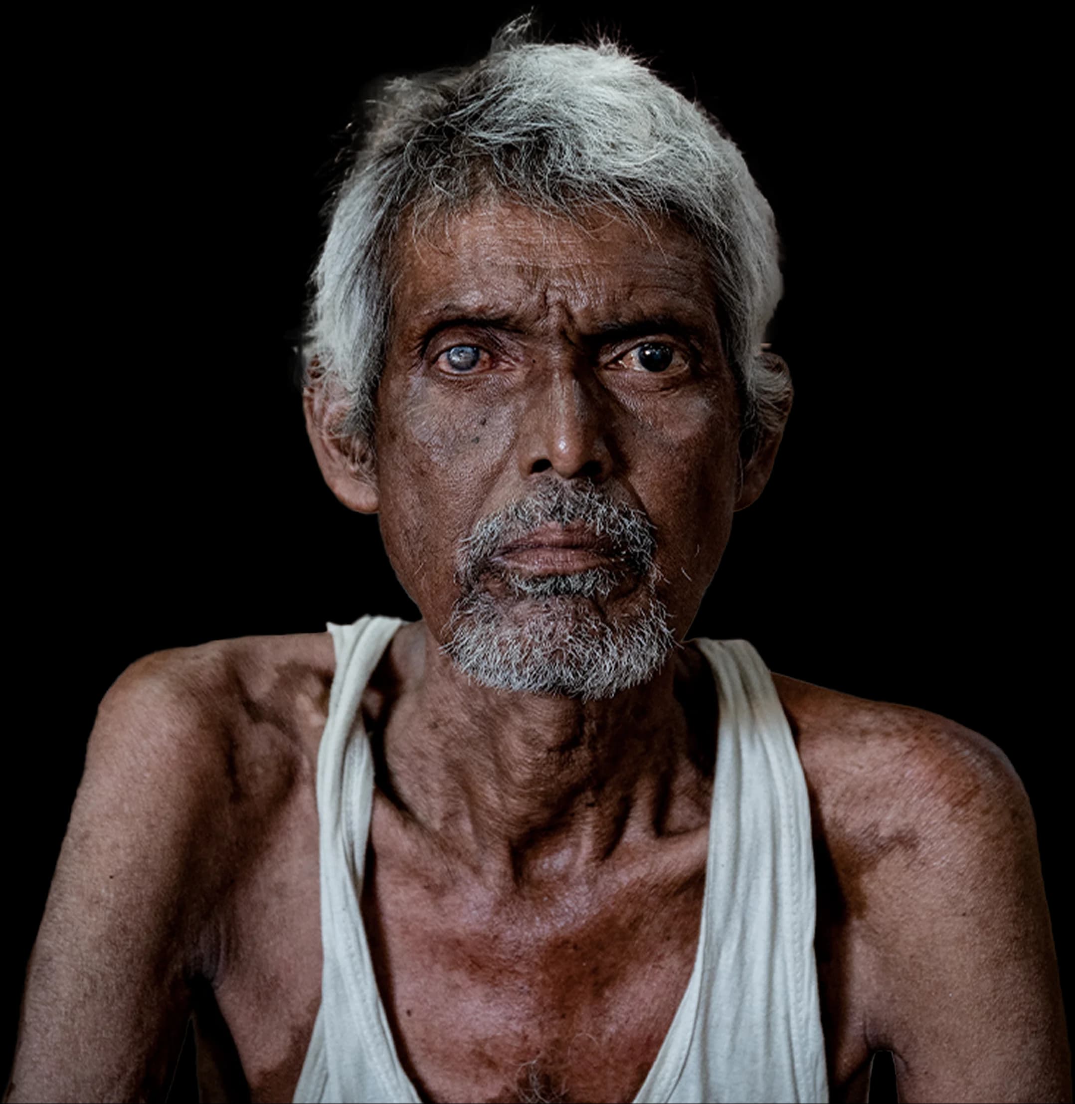 Why blindness matters