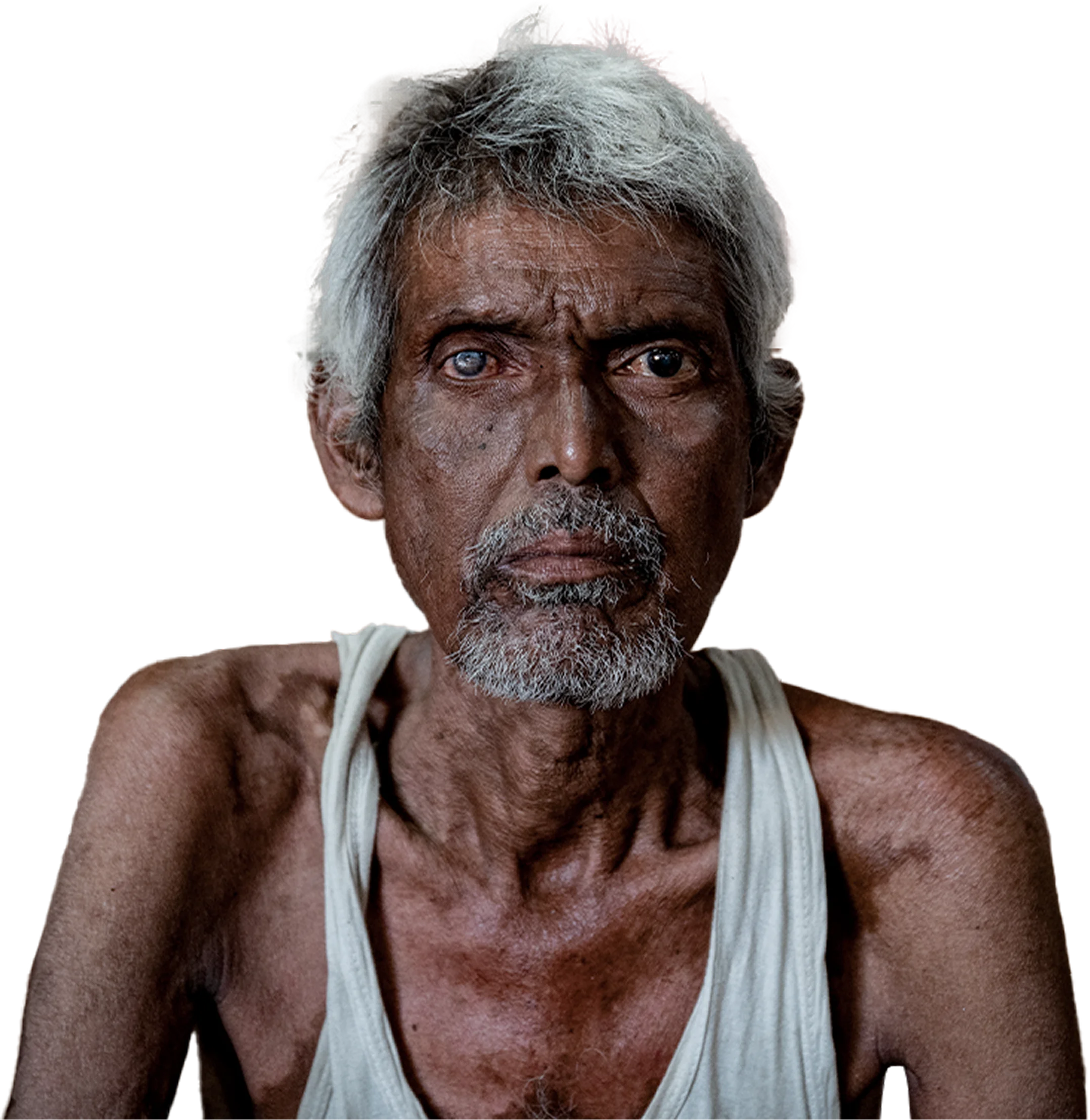 Why blindness matters
